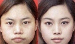 西安整容爆料案件最新情况,真相逐步浮出水面